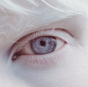albino oko